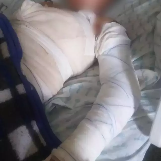 Homem é preso suspeito de queimar adolescente de 17 anos em fazenda
